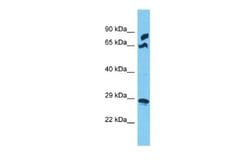 MRPS5 Rabbit anti-Human, Polyclonal, Novus Biologicals 0.1 mL | Buy Online | Novus Biologicals | Fisher Scientific